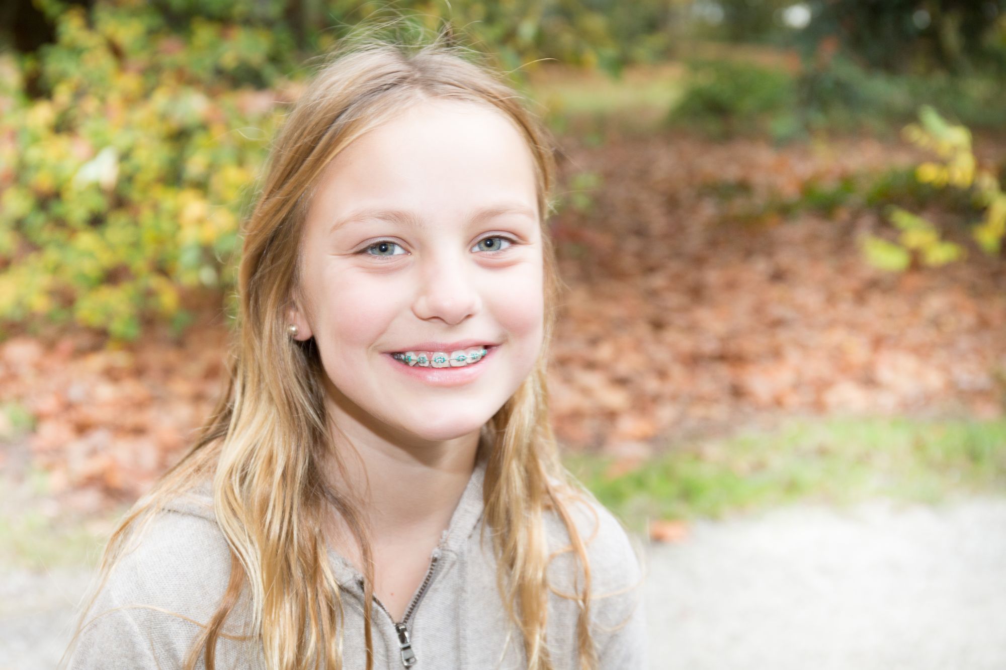 The Ultimate Guide to Metal Braces: Everything You Need to Know
