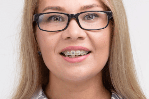 woman wearing glasses smiling with braces