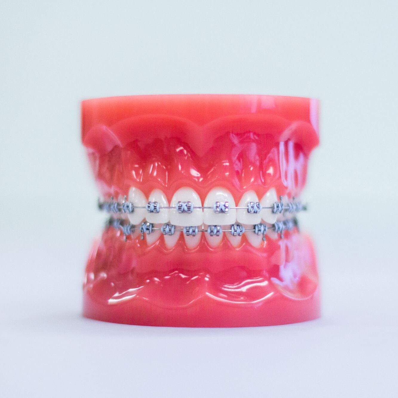 orthodontics windermere