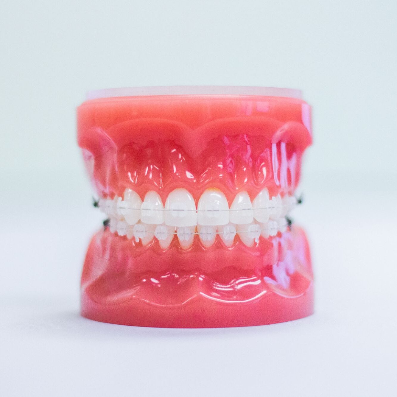 orthodontics windermere
